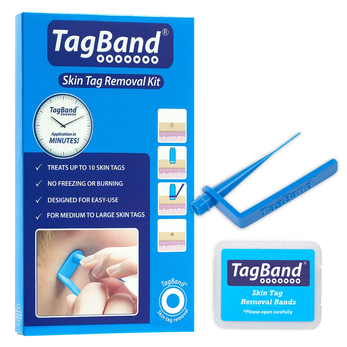 TagBand skin-tag removal kit packaging